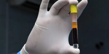 دراسة تكشف مفاجأة عن فيروس كورونا